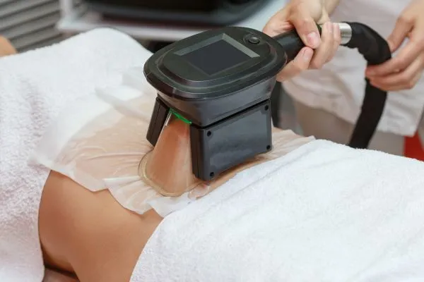 Image of person having fat freezing treatment to help weight gain
