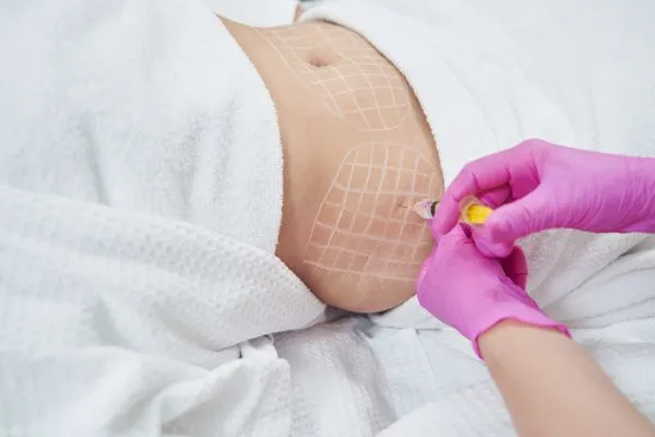 image of fat dissolving injections on love handles to help combat weight gain