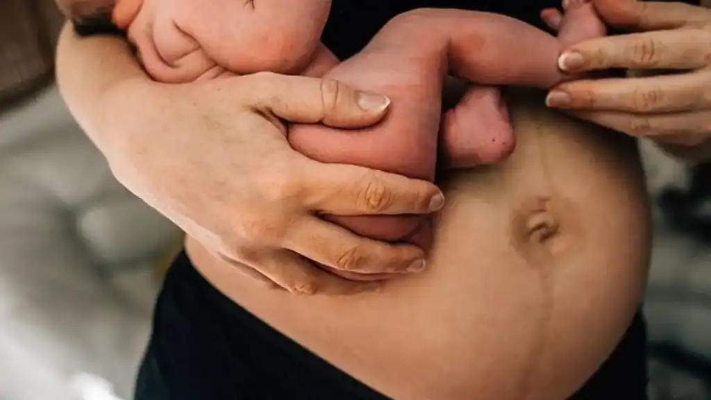 Why Is My Stomach Still Big After Pregnancy ?