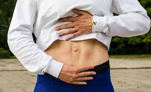 When Could Diastasis Recti Be the Missing Piece of the Puzzle ?